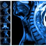 Do I need an MRI scan?